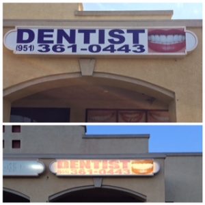 before and after lightbox design and reface